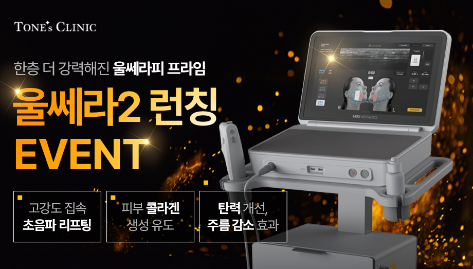 팝업